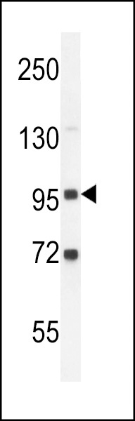 GPLD1 Antibody