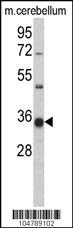 GGPS1 Antibody