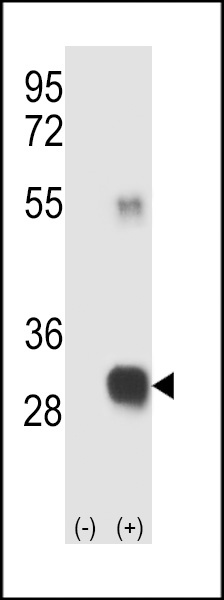 RCE1 Antibody