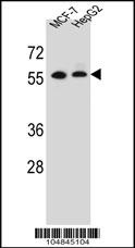 MGAT2 Antibody