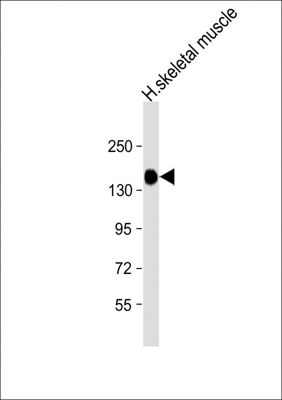 AGL Antibody