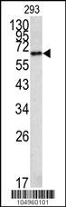 Methionine Aminopeptidase 2 Antibody