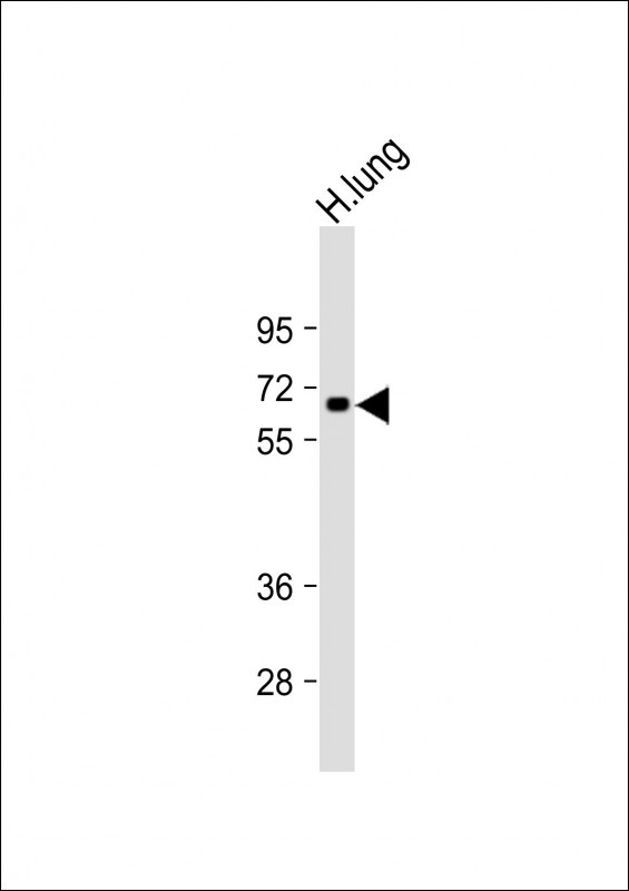 CSRNP1 Antibody