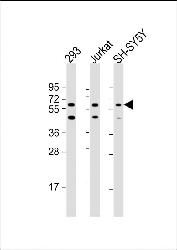 HEXDC Antibody