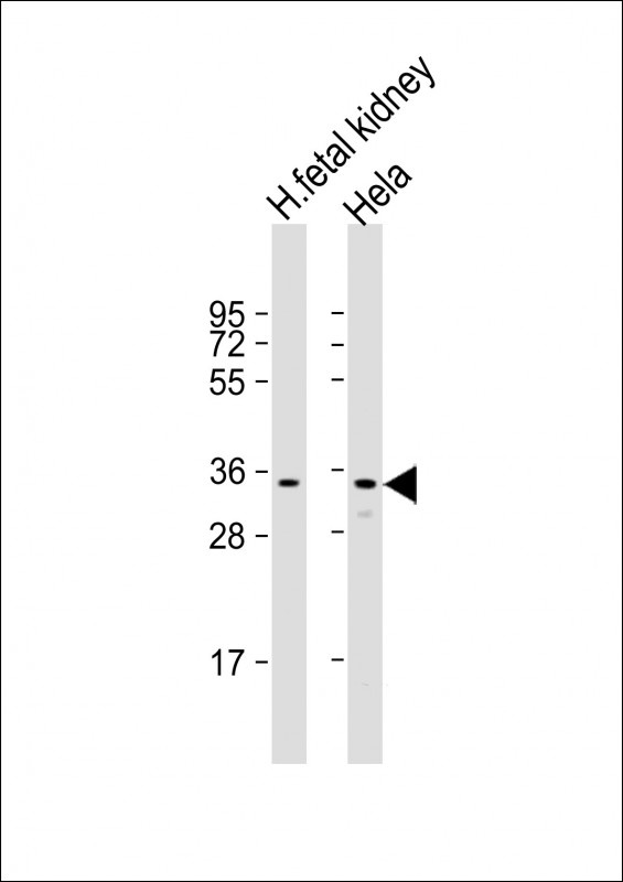 UPP1 Antibody