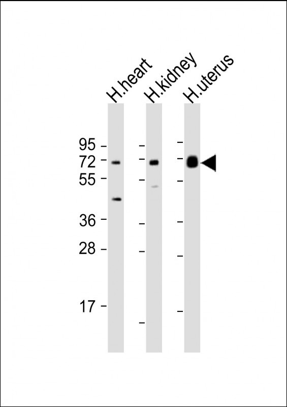 SPTLC3 Antibody