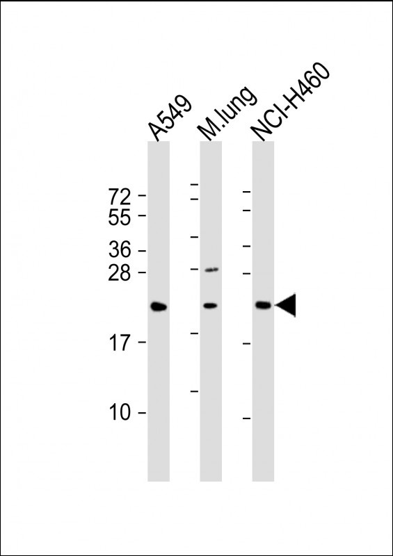 TUSC1 Antibody