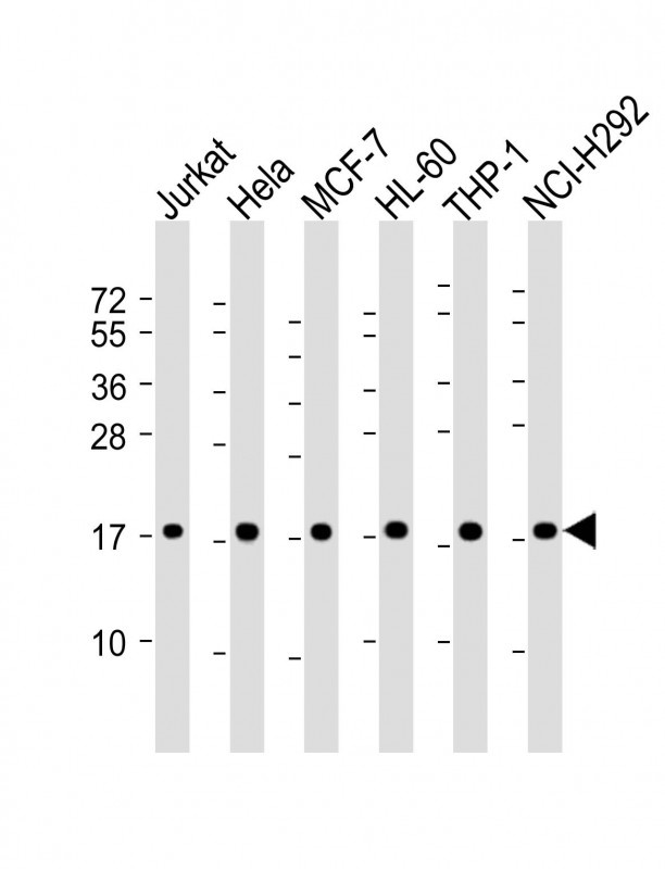 RPS17 Antibody