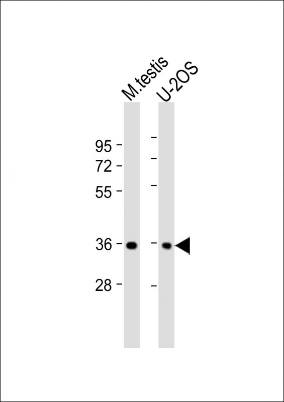 HEXIM2 Antibody