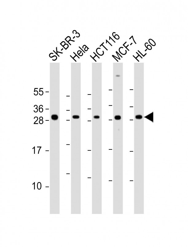 NAA10 Antibody