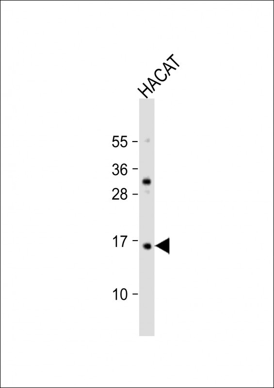 TCTA Antibody