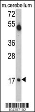 UBE2V1 Antibody