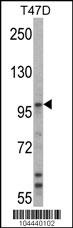 UBE3A Antibody