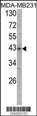 USP12/USP46 Antibody