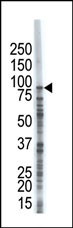 USP8 Antibody