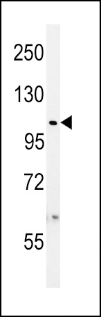 USP8 Antibody