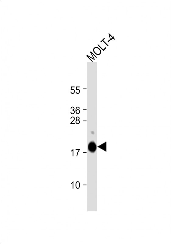 UBE2L6 Antibody