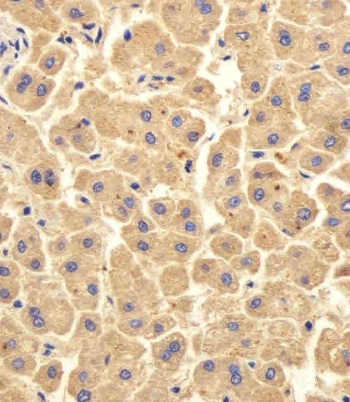 UBE2D1 Antibody