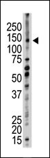 UBE4B Antibody