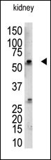 RBCK1 Antibody