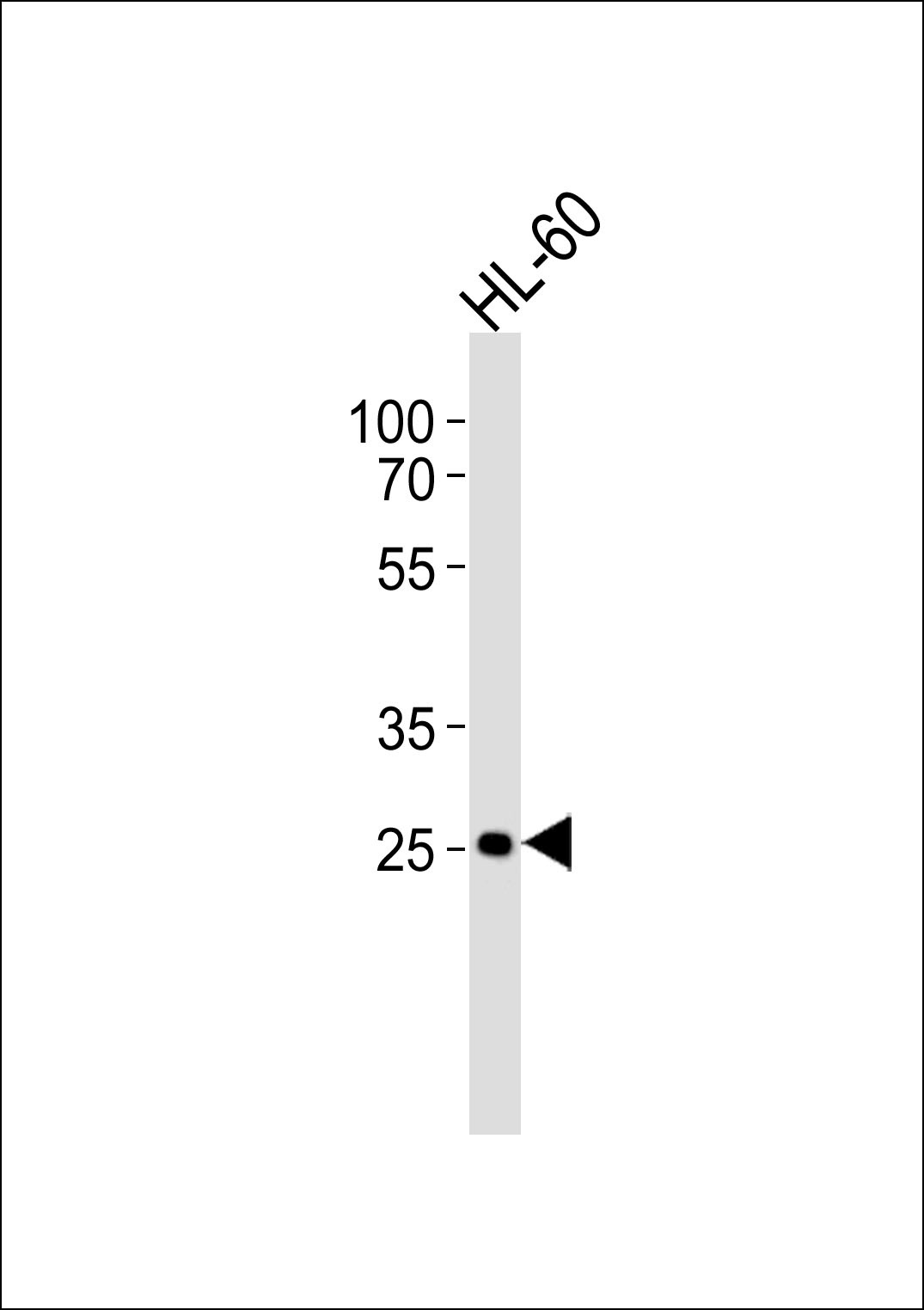 FCGR3B Antibody