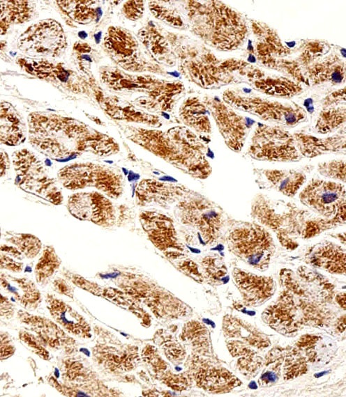 ZNF175 Antibody