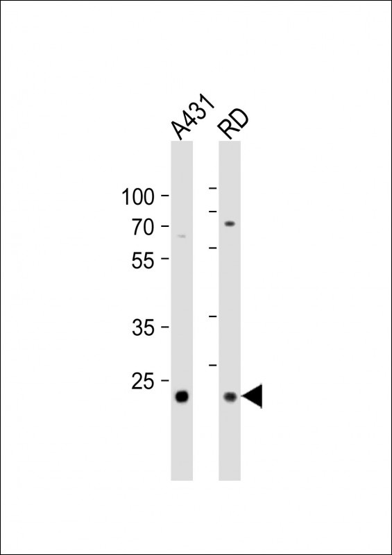 MMAB Antibody