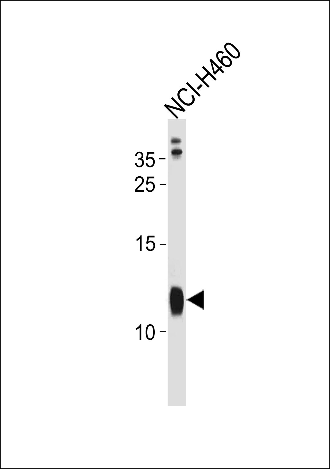 RPS21 Antibody