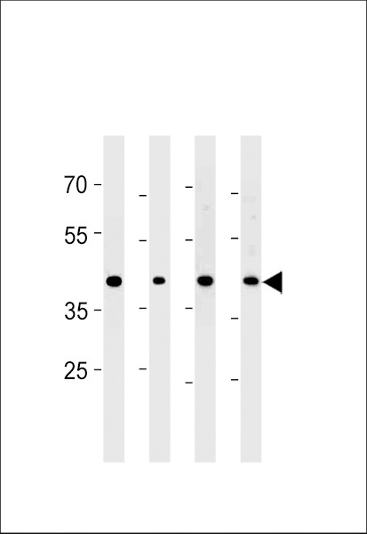 CABLES2 Antibody