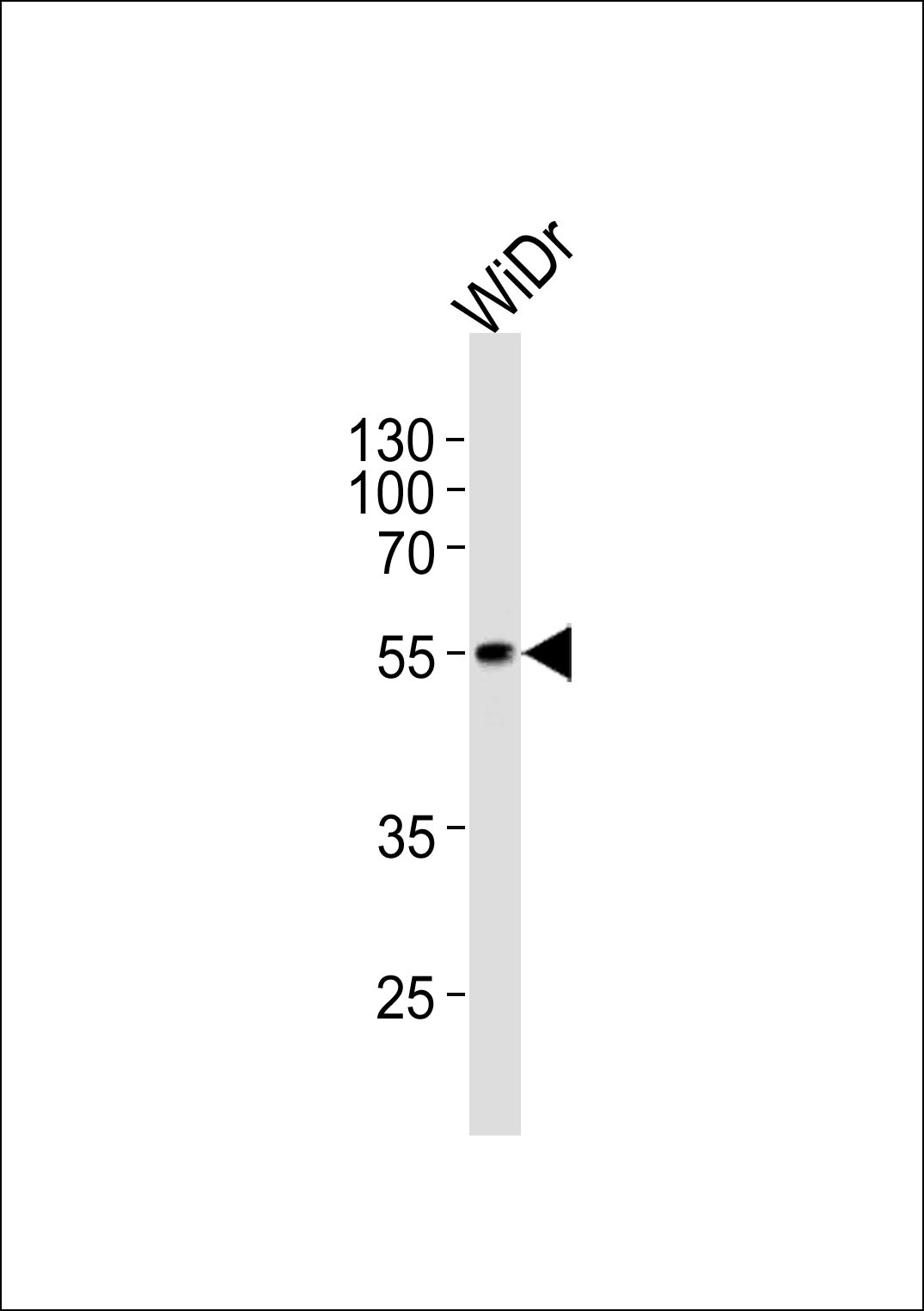 PDX1 Antibody
