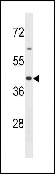 OR2B6 Antibody