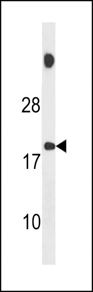 SPANXB1 Antibody