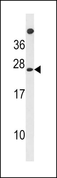 MPDU1 Antibody