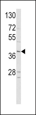 NEUROD1 Antibody