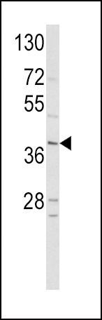 NeuroD1 Antibody
