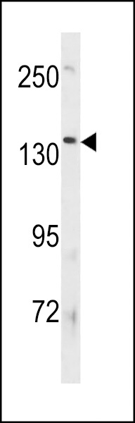 ATP8B3 Antibody