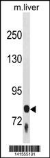 F13B Antibody