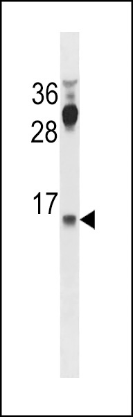 CYYR1 Antibody