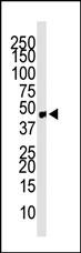 Chemokine Receptor D6 Antibody