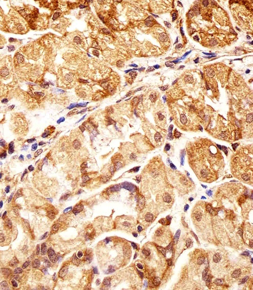 POLDIP3 Antibody