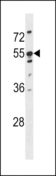 KRT86 Antibody