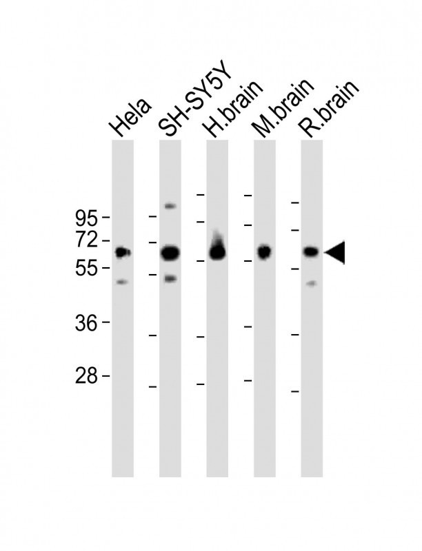 GDI1 Antibody