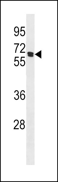 CHRNB4 Antibody