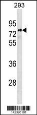 PARP6 Antibody