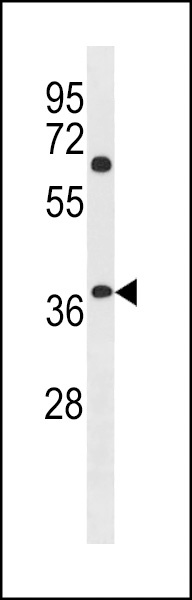 NHLRC3 Antibody