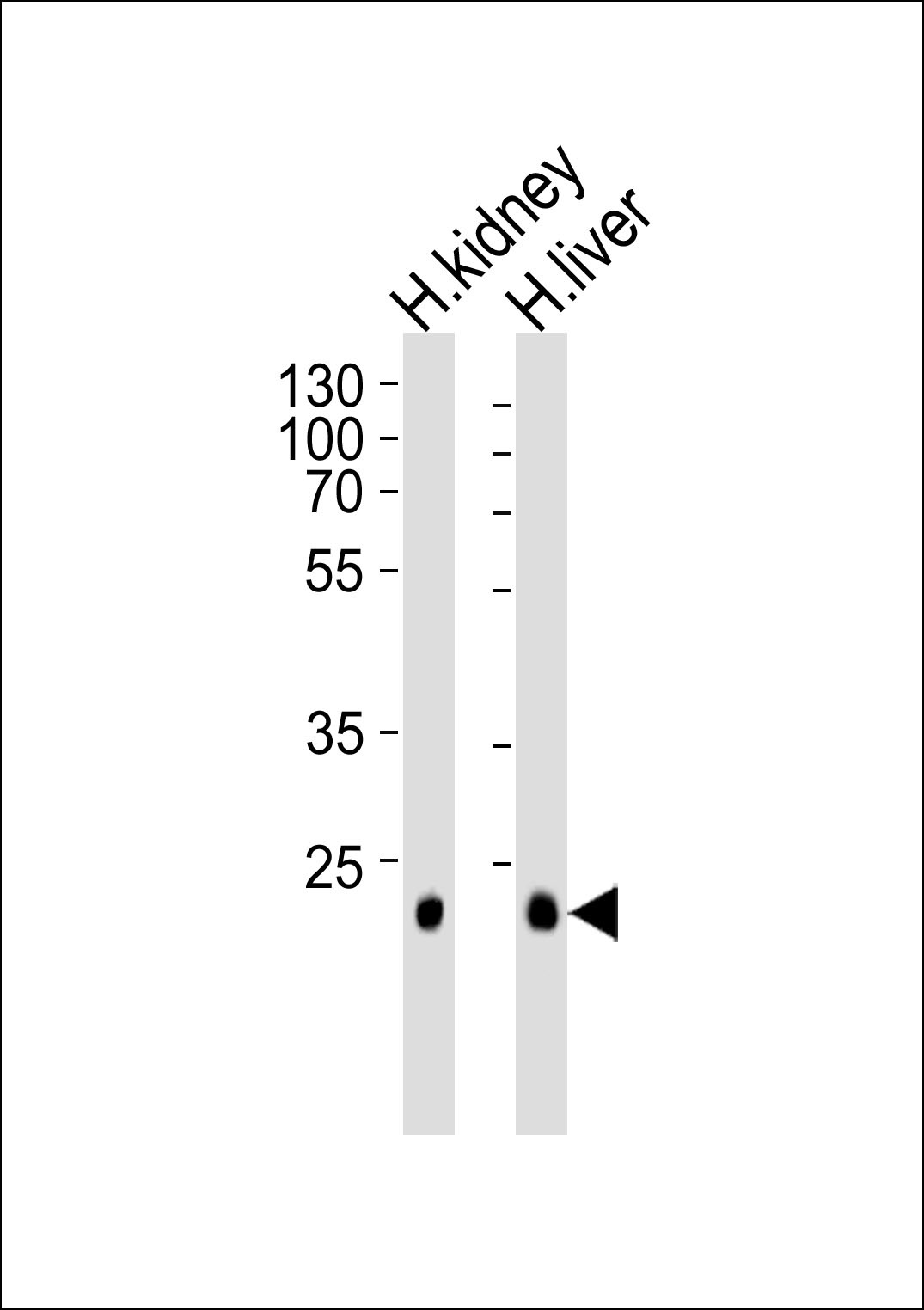 CLDN14 Antibody