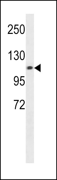 CHSY3 Antibody