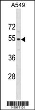 PUS10 Antibody