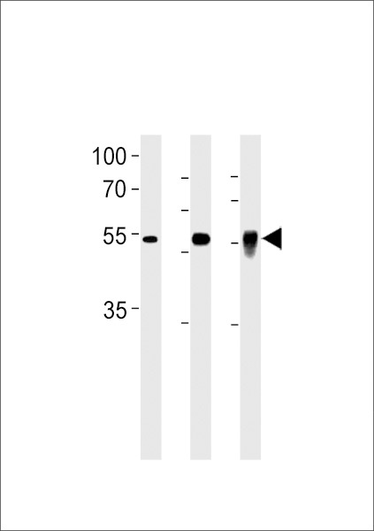 DMRTA2 Antibody