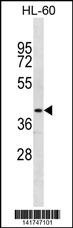 NR2E1 Antibody